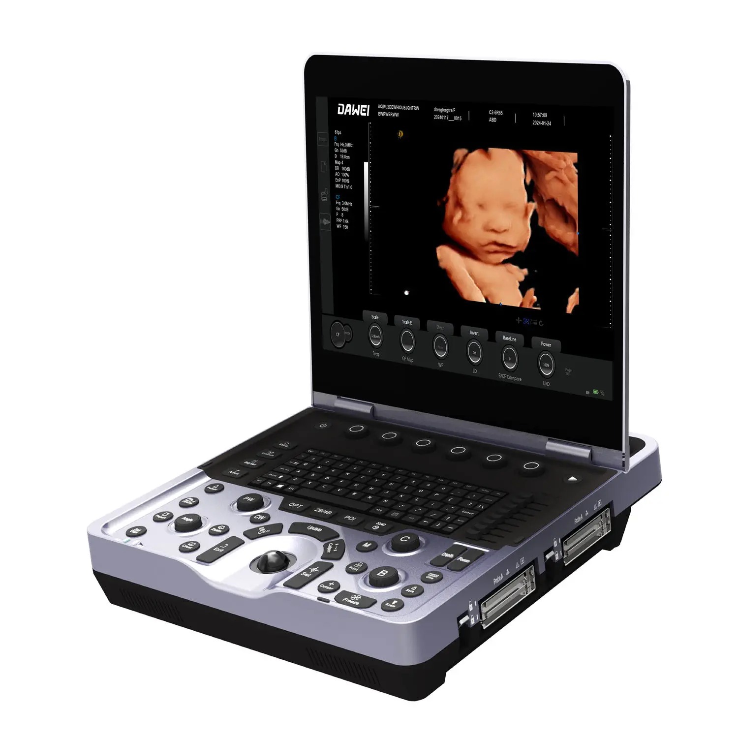 Ultrassom com Doppler Colorido Portátil DW-L30 L3S